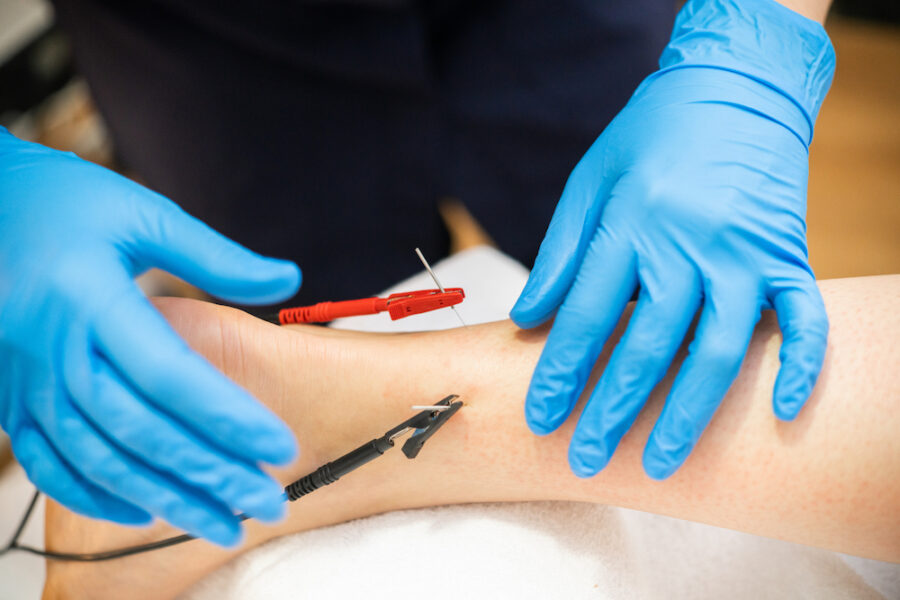 Functional Dry Needling [VIDEO]