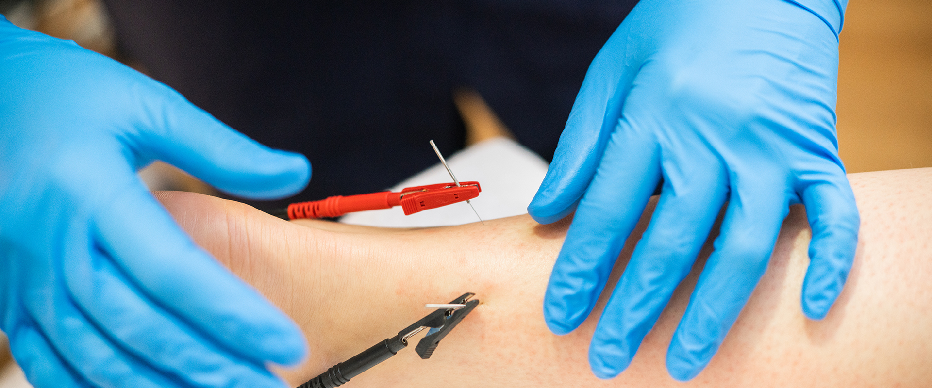 Dry Needling